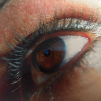 Eye